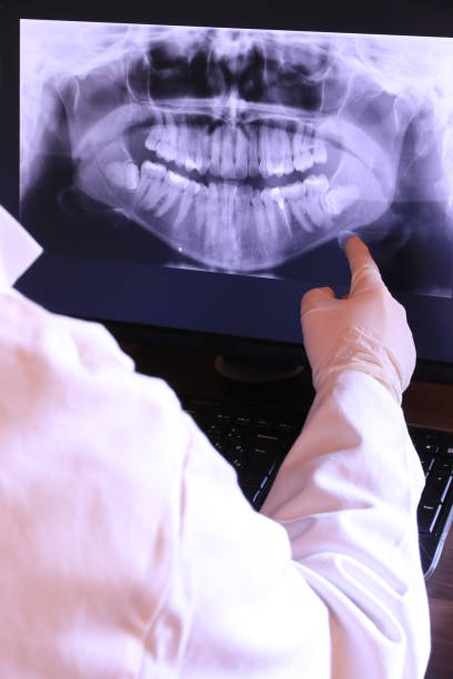 Best Emergency TMJ Treatment in Iselin, NJ